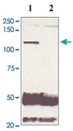 AR Rabbit anti-Human, Mouse, Rat, Polyclonal Antibody, Abnova 100 &mu;g | Buy Online | Abnova | Fisher Scientific