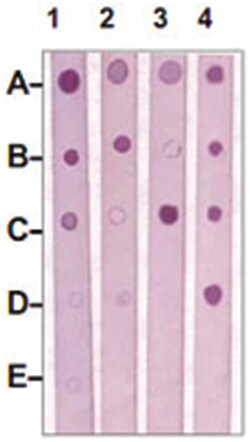 MST1R Rabbit anti-Human, Mouse, Rat, Polyclonal Antibody, Abnova 100&mu;g;