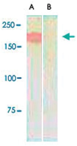 MST1R Rabbit anti-Human, Mouse, Rat, Polyclonal Antibody, Abnova 100&mu;g;