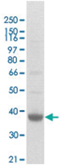 MS4A1 Rabbit anti-Human, Polyclonal Antibody, Abnova 100&mu;g; Unlabeled:Antibodies,