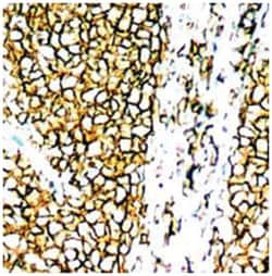 MS4A1 Rabbit anti-Human, Polyclonal Antibody, Abnova 100&mu;g; Unlabeled:Antibodies,