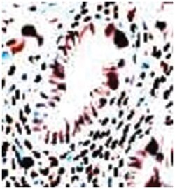 ESR2 Rabbit anti-Human, Mouse, Rat, Polyclonal Antibody, Abnova 100&mu;g;