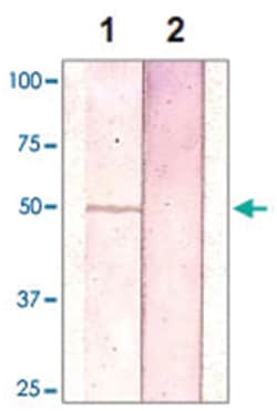 GSK3B Rabbit anti-Human, Mouse, Rat, Polyclonal Antibody, Abnova 100&mu;g;