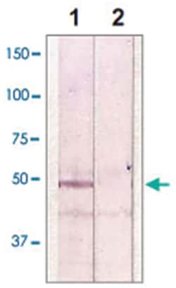 GSK3B Rabbit anti-Human, Mouse, Rat, Polyclonal Antibody, Abnova 100&mu;g;