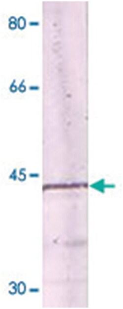 NFKBIA Rabbit anti-Human, Mouse, Rat, Polyclonal Antibody, Abnova 100 &mu;g | Buy Online | Abnova Corporation | Fisher Scientific
