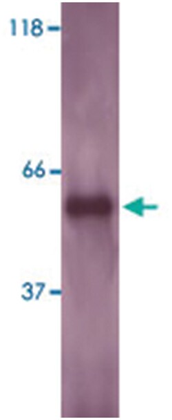 LSP1 Rabbit anti-Human, Mouse, Polyclonal Antibody, Abnova 100 &mu;g | Buy Online | Abnova Corporation | Fisher Scientific