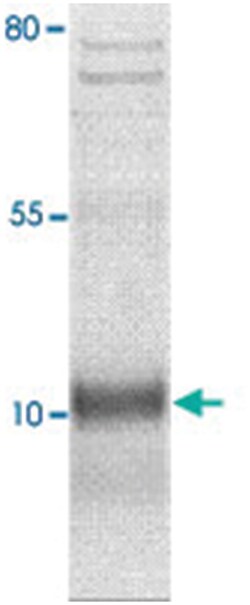 SCGB2A2, Rabbit, Polyclonal Antibody, Abnova 100 &mu;g | Buy Online | Abnova | Fisher Scientific