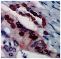 SCGB2A2, Rabbit, Polyclonal Antibody, Abnova 100 &mu;g | Buy Online | Abnova | Fisher Scientific