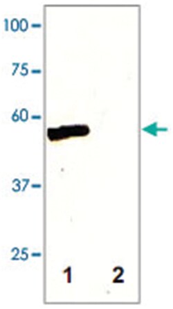 MAP2K5 Rabbit anti-Chicken, Human, Mouse, Rat, Polyclonal Antibody, Abnova 100 &mu;g | Buy Online | Abnova | Fisher Scientific