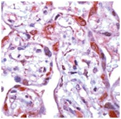 MMP1 Rabbit anti-Human, Mouse, Rat, Polyclonal Antibody, Abnova 100&mu;g;