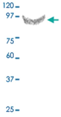 MMP9 Rabbit anti-Human, Polyclonal Antibody, Abnova 100&mu;g; Unlabeled:Antibodies,