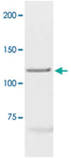 PGR Rabbit anti-Human, Polyclonal Antibody, Abnova 100&mu;g; Unlabeled:Antibodies,
