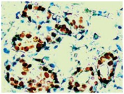 PGR Rabbit anti-Human, Polyclonal Antibody, Abnova 100&mu;g; Unlabeled:Antibodies,