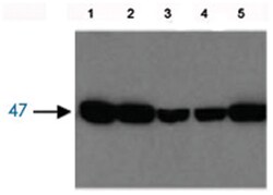 Fah, Rabbit, Polyclonal Antibody, Abnova 100&mu;g; Unlabeled:Antibodies,