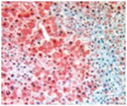 Fah, Rabbit, Polyclonal Antibody, Abnova 100&mu;g; Unlabeled:Antibodies,