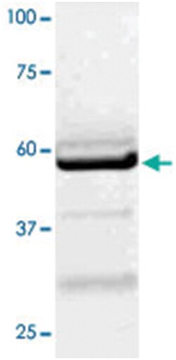 LCK Rabbit anti-Human, Mouse, Rat, Polyclonal Antibody, Abnova 100 &mu;g | Buy Online | Abnova Corporation | Fisher Scientific