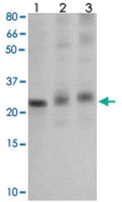 SOCS1 Rabbit anti-Human, Mouse, Polyclonal Antibody, Abnova 100&mu;g; Unlabeled:Antibodies,