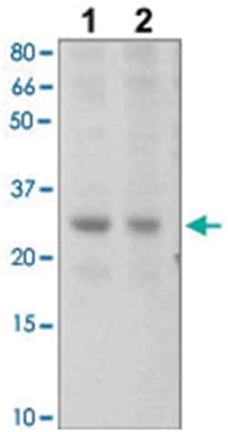 SOCS2 Rabbit anti-Human, Mouse, Polyclonal Antibody, Abnova 100&mu;g; Unlabeled:Antibodies,