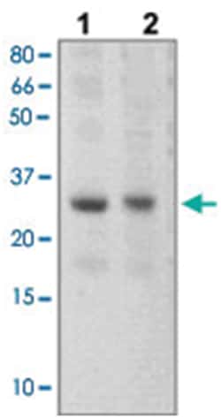 SOCS3 Rabbit anti-Human, Mouse, Polyclonal Antibody, Abnova 100 &mu;g | Buy Online | Abnova | Fisher Scientific
