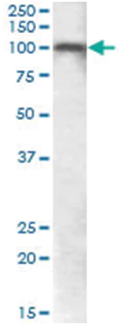 GRM7, Goat, Polyclonal Antibody, Abnova 100&mu;g; Unlabeled:Antibodies,