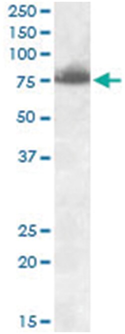 DLL1, Goat, Polyclonal Antibody, Abnova 100&mu;g; Unlabeled:Antibodies,