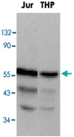 DOK1 Rabbit anti-Human, Polyclonal Antibody, Abnova 100&mu;g; Unlabeled:Antibodies,