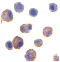 TNFRSF10B Rabbit anti-Human, Mouse, Polyclonal Antibody, Abnova 100&mu;g;