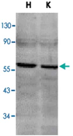 TNFRSF10B Rabbit anti-Human, Mouse, Polyclonal Antibody, Abnova 100&mu;g;