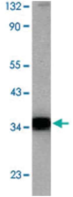 TNFRSF10D Rabbit anti-Human, Mouse, Rat, Polyclonal Antibody, Abnova 100&mu;g;