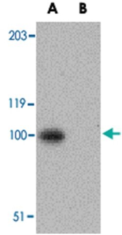 NPHS1 Rabbit anti-Human, Mouse, Rat, Polyclonal Antibody, Abnova 100&mu;g;