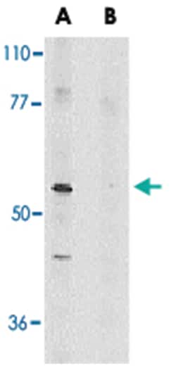 RIPK3 Rabbit anti-Mouse, Rat, Polyclonal Antibody, Abnova 100&mu;g; Unlabeled:Antibodies,