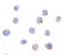 IKBKAP Rabbit anti-Human, Mouse, Polyclonal Antibody, Abnova 100&mu;g;