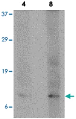 P53AIP1, Rabbit, Polyclonal Antibody, Abnova 100&mu;g; Unlabeled:Antibodies,