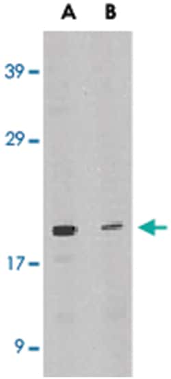 IL21 Rabbit anti-Human, Polyclonal Antibody, Abnova 100&mu;g; Unlabeled:Antibodies,