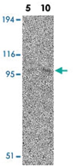 CARD10 Rabbit anti-Human, Mouse, Polyclonal Antibody, Abnova 100&mu;g;