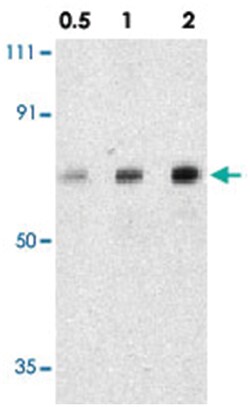AATF, Rabbit, Polyclonal Antibody, Abnova 100 &mu;g | Buy Online | Abnova Corporation | Fisher Scientific