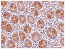 AATF, Rabbit, Polyclonal Antibody, Abnova 100 &mu;g | Buy Online | Abnova Corporation | Fisher Scientific