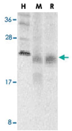 TNFRSF13C Rabbit anti-Human, Mouse, Rat, Polyclonal Antibody, Abnova 100&mu;g;
