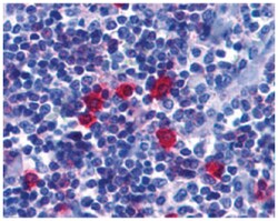 TNFRSF13C Rabbit anti-Human, Mouse, Rat, Polyclonal Antibody, Abnova 100&mu;g;
