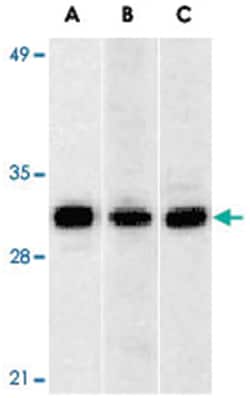 ANP32A Rabbit anti-Human, Mouse, Rat, Polyclonal Antibody, Abnova 100 &mu;g | Buy Online | Abnova Corporation | Fisher Scientific