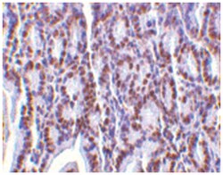 ANP32A Rabbit anti-Human, Mouse, Rat, Polyclonal Antibody, Abnova 100 &mu;g | Buy Online | Abnova Corporation | Fisher Scientific