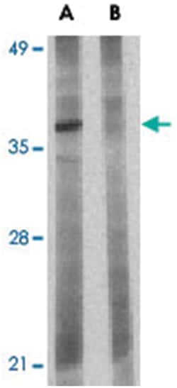 BCL2L10, Rabbit, Polyclonal Antibody, Abnova 100&mu;g; Unlabeled:Antibodies,