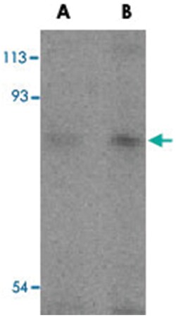 TICAM1 Rabbit anti-Human, Polyclonal Antibody, Abnova 100&mu;g; Unlabeled:Antibodies,