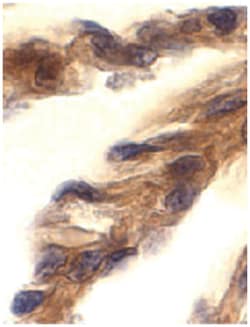 TICAM1 Rabbit anti-Human, Polyclonal Antibody, Abnova 100&mu;g; Unlabeled:Antibodies,