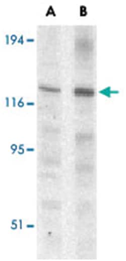 Casp12 Rabbit anti-Human, Mouse, Rat, Polyclonal Antibody, Abnova 100&mu;g;