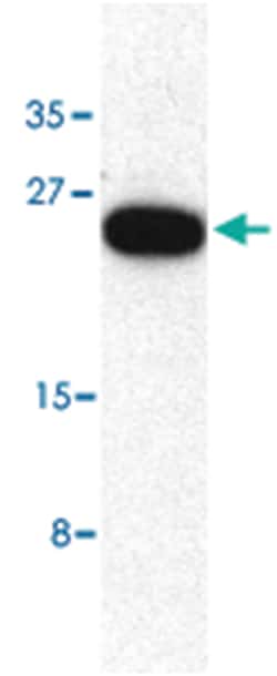 TRIM5 Rabbit anti-Human, Polyclonal Antibody, Abnova 100&mu;g; Unlabeled:Antibodies,