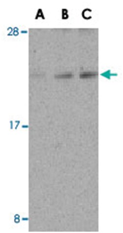 DAD1, Rabbit, Polyclonal Antibody, Abnova 100&mu;g; Unlabeled:Antibodies,