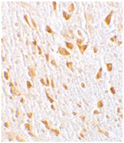 AGAP2 Rabbit anti-Human, Mouse, Polyclonal Antibody, Abnova 100&mu;g; Unlabeled:Antibodies,