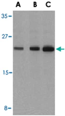BAD Rabbit anti-Human, Mouse, Rat, Polyclonal Antibody, Abnova 100&mu;g;