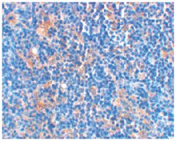 BAD Rabbit anti-Human, Mouse, Rat, Polyclonal Antibody, Abnova 100&mu;g;